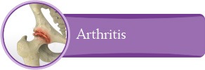Arthritis