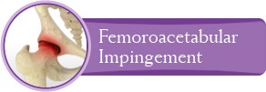Femoroacetabular Impingement