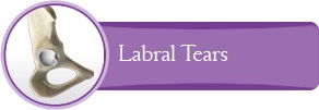 Labral Tears