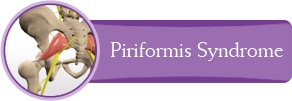 Piriformis Syndrome